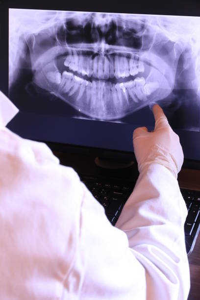 Best Emergency Dental Surgery in Dana, NC