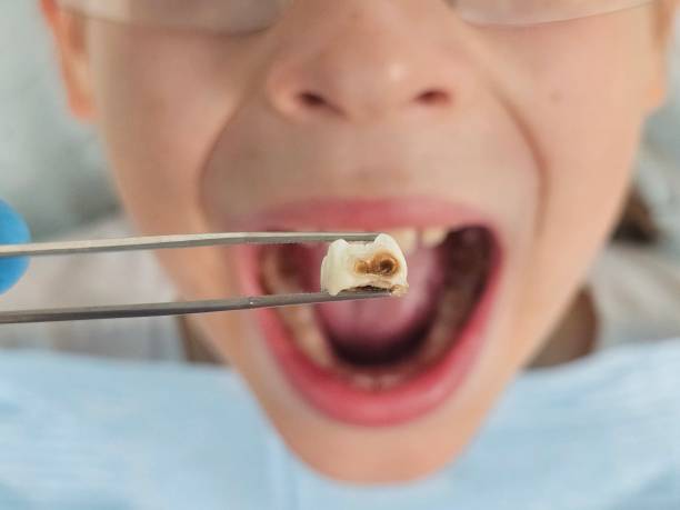 Best Emergency Treatment for Toothache in Dana, NC